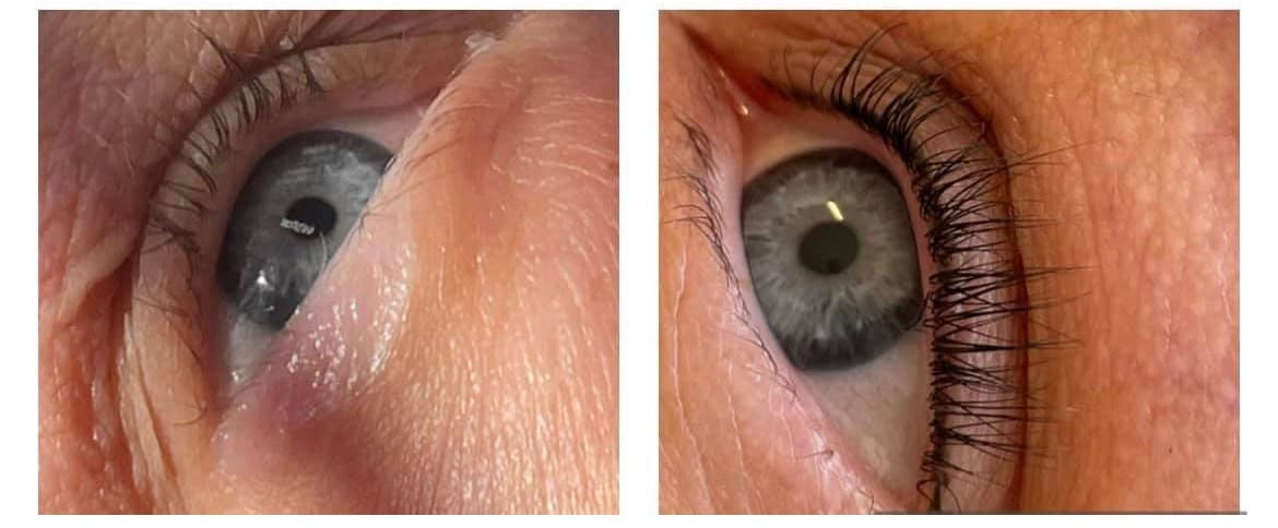 Lash Lift before and after closeup
