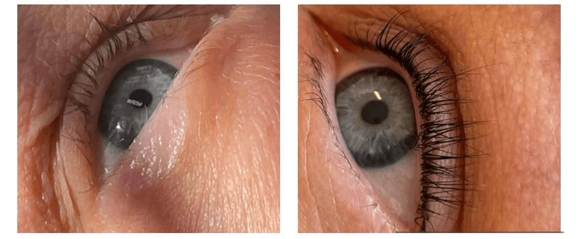 Lash PMU before and after