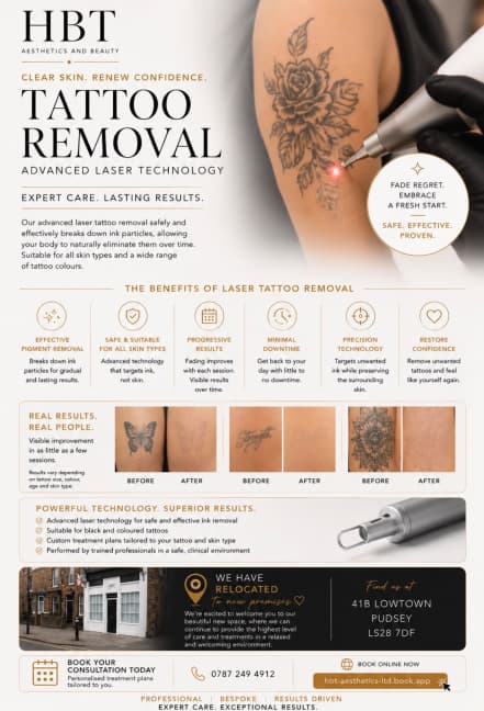 Tattoo Removal — Advanced Laser Technology at HBT Aesthetics & Beauty